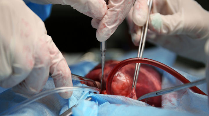 Com 304 doações, Rio de Janeiro bate recorde de transplante de órgãos