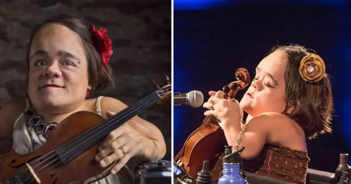 Mulher com doença óssea desafia limites e encontra nova maneira de tocar violino