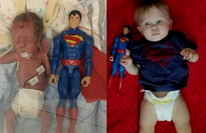 A vitória do bebê que nasceu do tamanho do boneco do Superman
