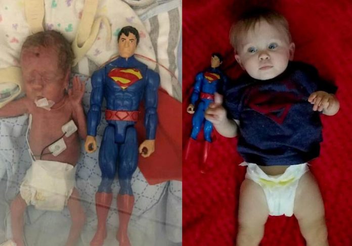 A vitória do bebê que nasceu do tamanho do boneco do Superman