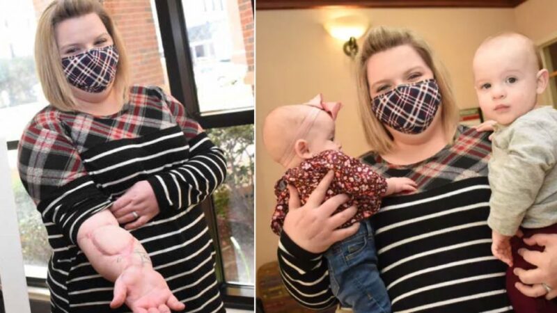 Médicos recolocaram o braço de mãe que sofreu acidente e ela pôde segurar seus bebês