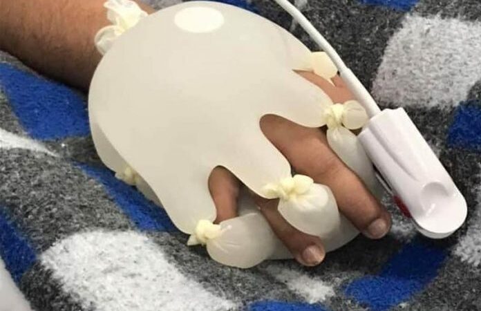 Enfermeira brasileira cria técnica da mãozinha para confortar pacientes
