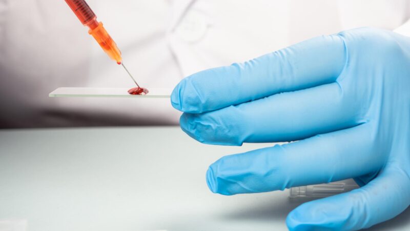 O que a ciência já sabe sobre a relação entre Covid-19 e grupos sanguíneos