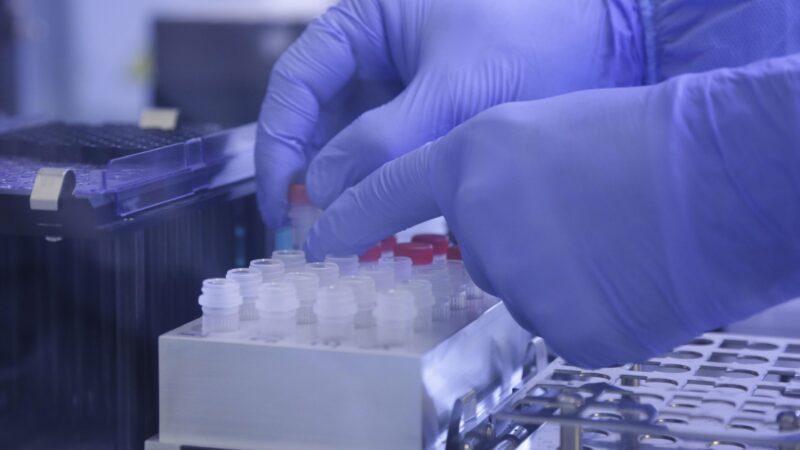 7 fatos sobre reinfecção pela Covid-19