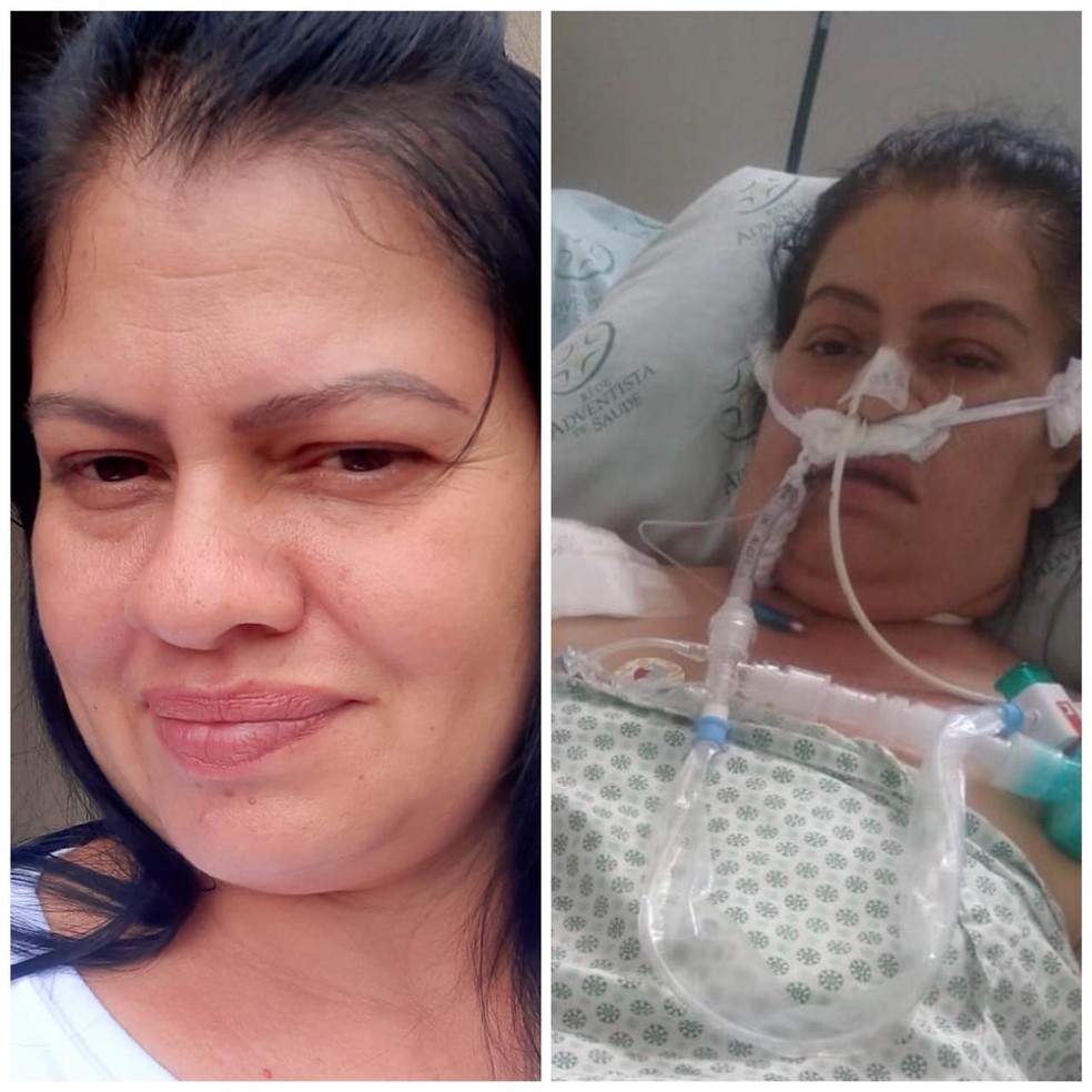 Intubada três vezes, com AVC e 30 dias no CTI, babá vence Covid em MS: ‘Só queria voltar para casa’