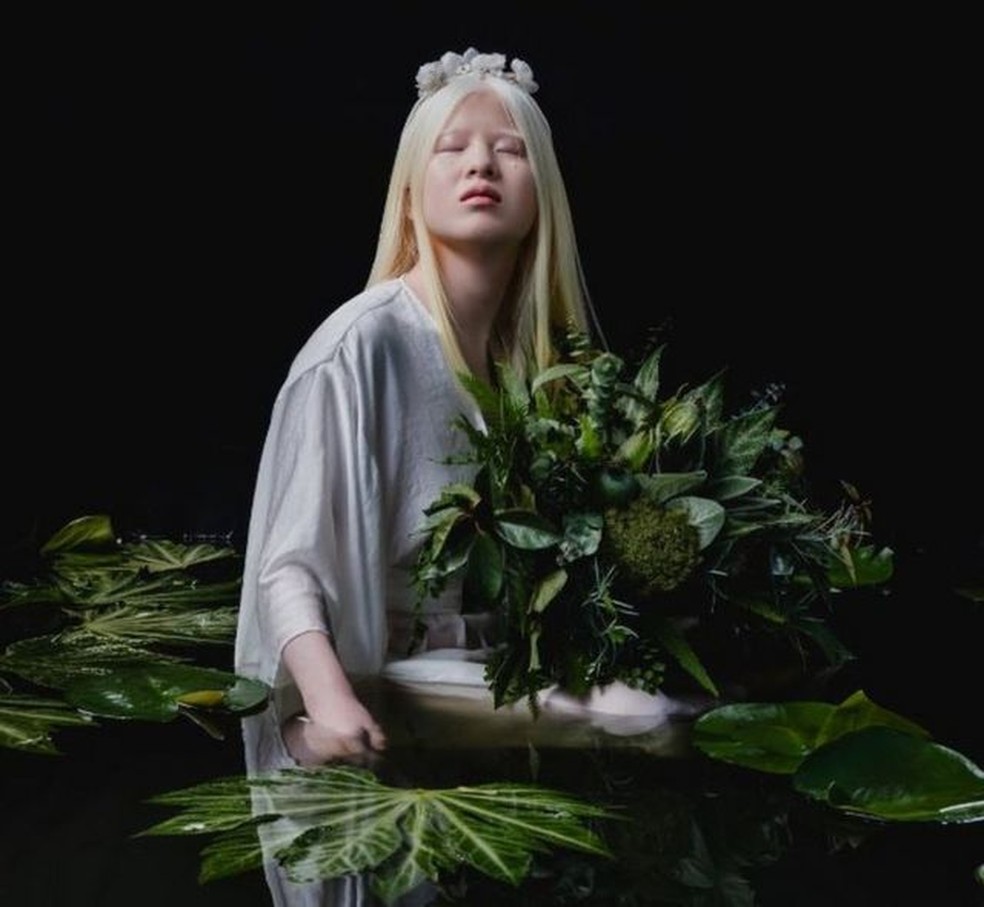 A chinesa albina abandonada bebê que se tornou modelo da Vogue