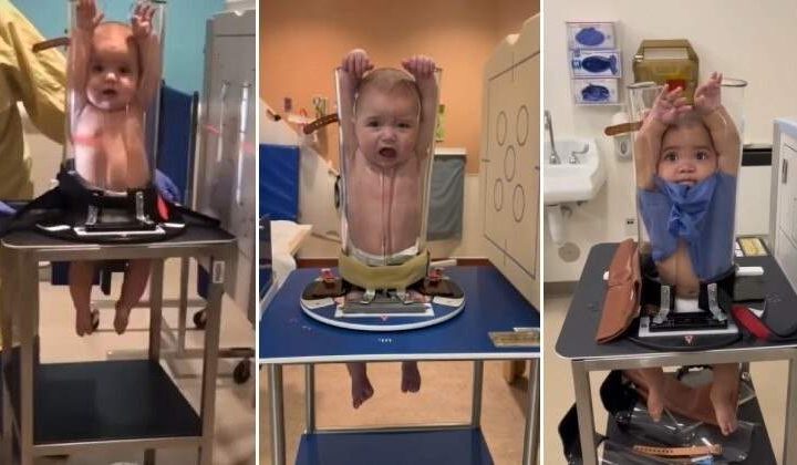 Vídeos de bebês em aparelho de raio-X viralizam. Assista